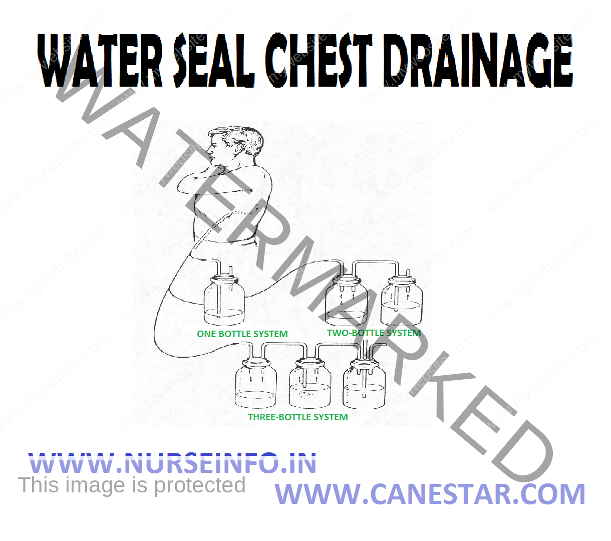 Water Seal Drainage System Bubbling at Violet James blog