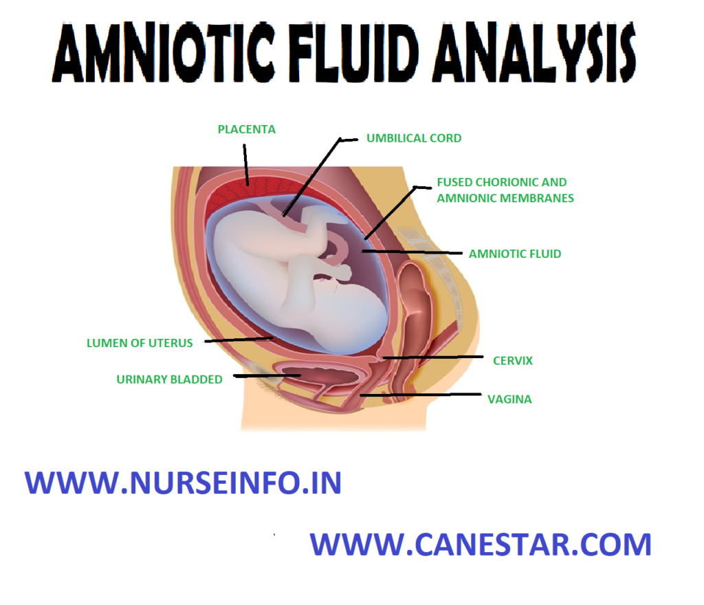 AMNIOTIC FLUID ANALYSIS – Purposes, Indications, General Instructions, Procedure, Factors Affecting Diagnostic Results, Nursing Implications, Client Teaching and Rare Complications (MATERNAL AND CHILD HEALTH NURSING) 
