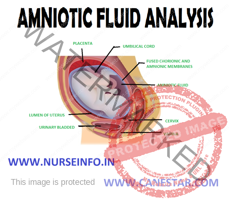 amniotic fluid definition