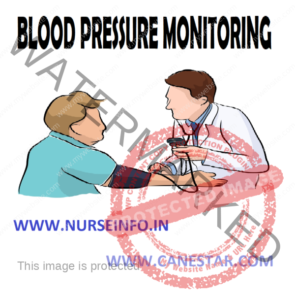 BLOOD PRESSURE MONITORING Nurse Info