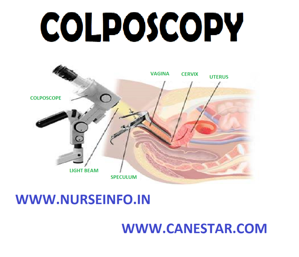 COLPOSCOPY – Purposes, Indications, Client Preparations, Procedure, Post-Procedural Care, Factors Affecting Diagnostic Results and Client Teaching (MATERNAL AND CHILD HEALTH NURSING) 