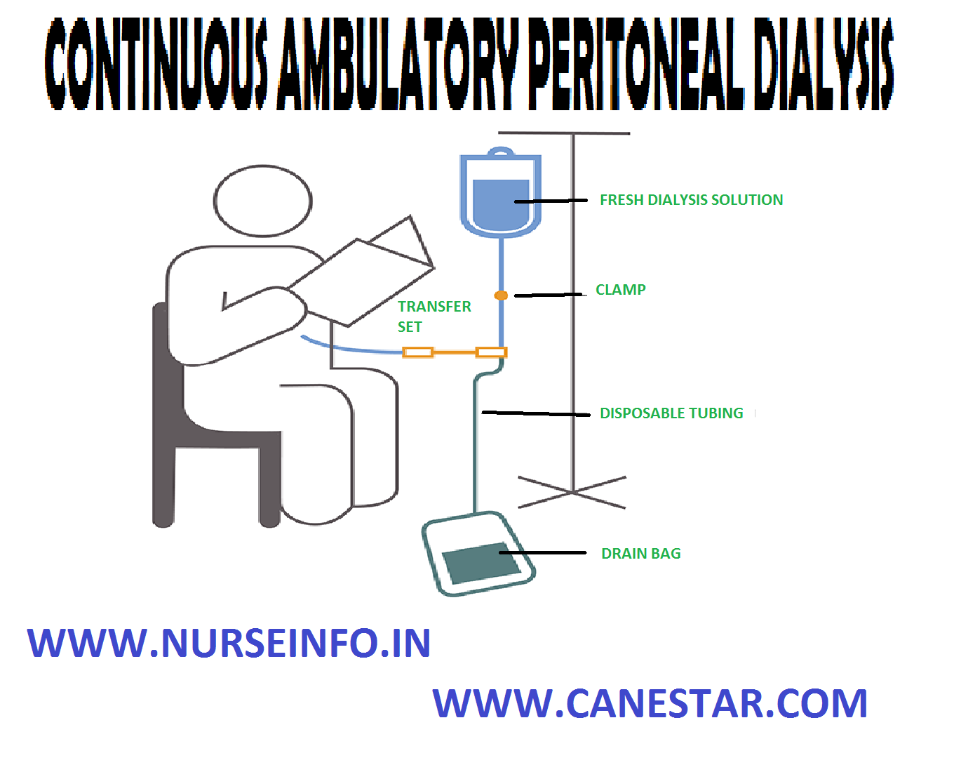 continuous-ambulatory-peritoneal-dialysis-nurse-info