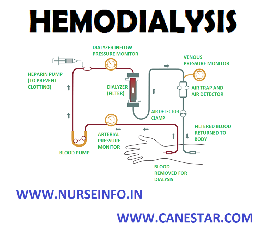 HEMODIALYSIS – Definition, Indications, Equipment, Preparation of Double Lumen Catheter for Dialysis, Preparation for AV Shunts for Diathesis, Equipment Needed after the Procedure, For AV Fistula, For AV Shunt, Preparation of Equipment, Sites for Hemodialysis, Mechanism of hemodialysis, Types of Dailyzers, Systems Used in Delivering Dialysate, Nursing Care, Role of Nurse in Care of Patient on Hemodialysis with Double Lumen catheter, Post-procedure Care, Nursing Alert and Complications (NURSING PROCEDURE) 