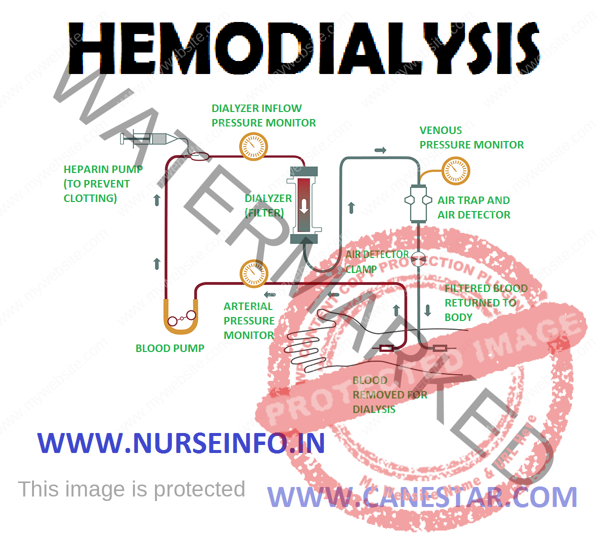 HEMODIALYSIS - Nurse Info