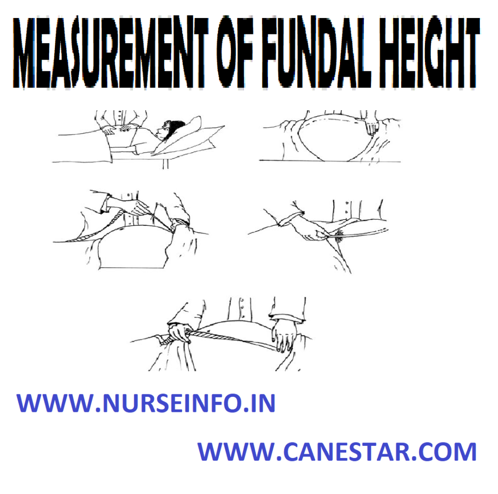MEASUREMENT OF FUNDAL HEIGHT – Methods and Procedures (MATERNAL AND CHILD HEALTH NURSING) 