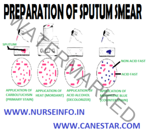 PREPARATION OF SPUTUM SMEAR - Nurse Info PREPARATION OF SPUTUM SMEAR ...