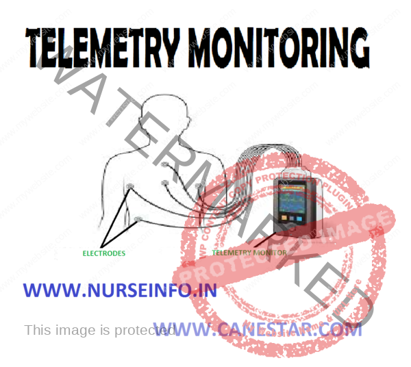 TELEMETRY MONITORING Nurse Info