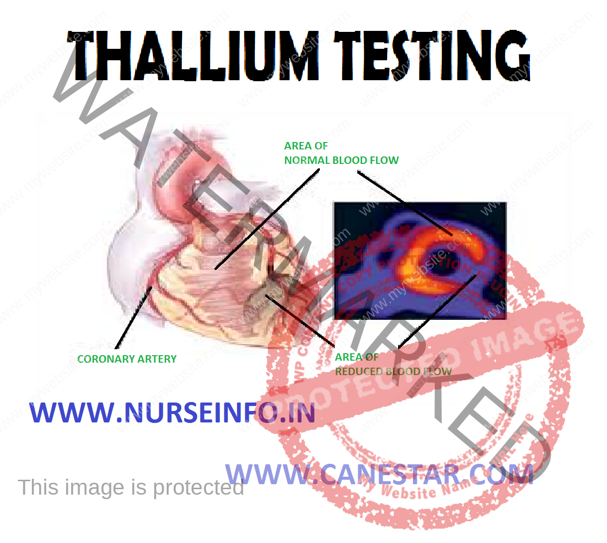 thallium-testing-nurse-info