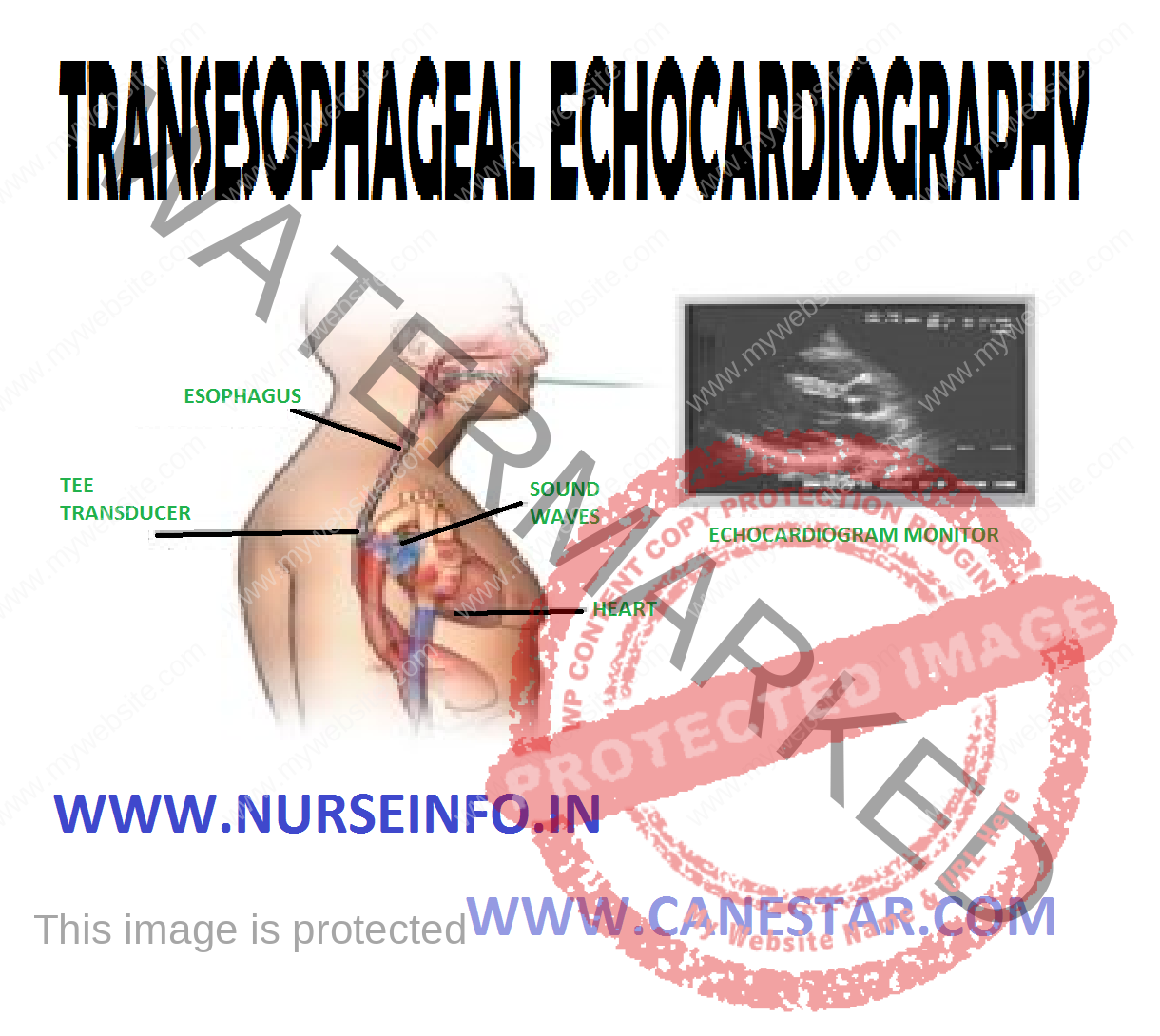 transesophageal-echocardiography-nurse-info