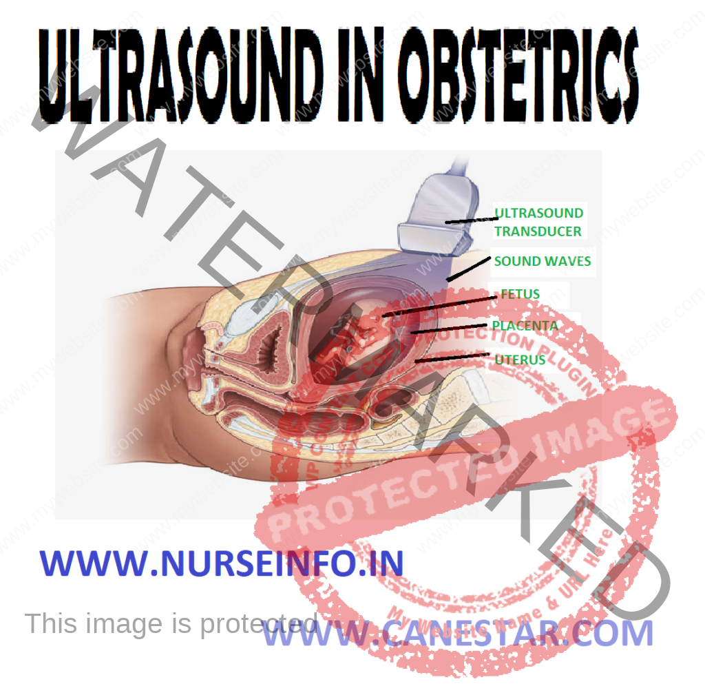 ULTRASOUND IN OBSTETRICS – ULTRASOUND WORKING, USE OF ULTRASOUND IN OBSTETRICS, TRANSVAGINAL ULTRASONOGRAPHY, DOPPLER ULTRASOUND AND MIDWIFE’S RESPONSIBILITY REGARDING PRENATAL SCREENING (Maternal and Child Health Nursing) 