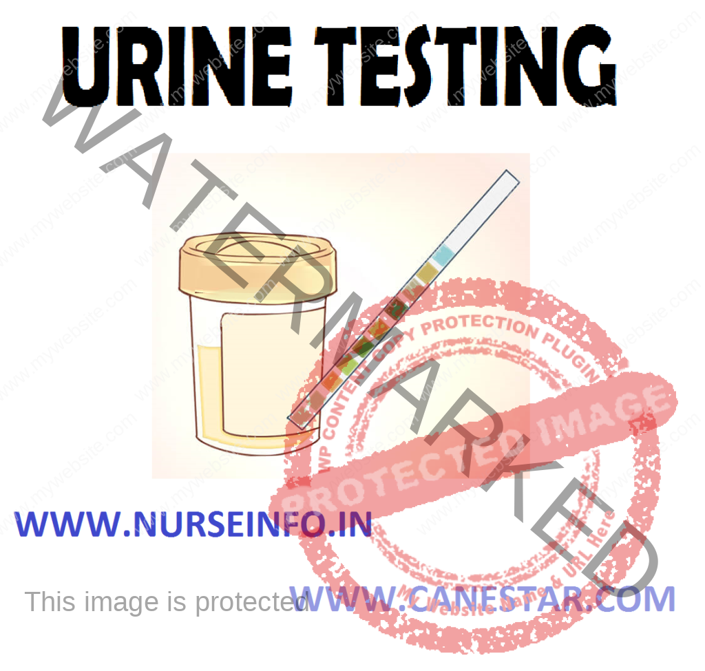 URINE TESTING – Purposes, Principle Involved, General Instructions, Equipment Needed Sugar and Albumin Test and Procedure (COMMUNITY HEALTH NURSING) 