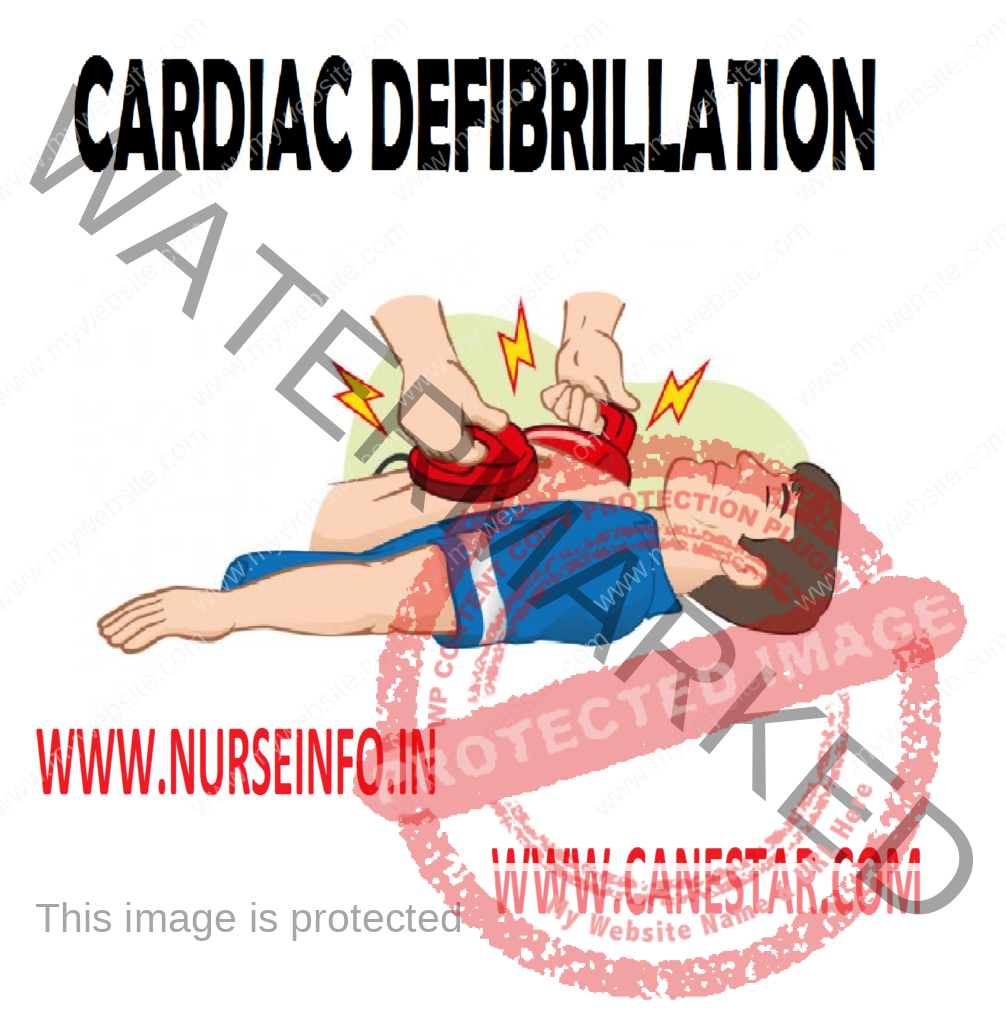 CARDIAC DEFIBRILLATION - Purpose, Equipment, Procedure, Types, Instructions, After care