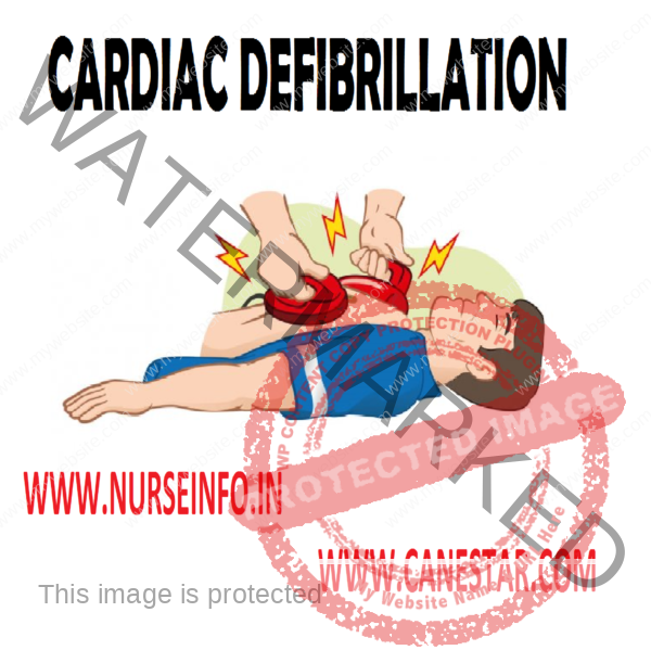 Defibrillation Failed Whats Next The Crucial Steps - 5tl84mu