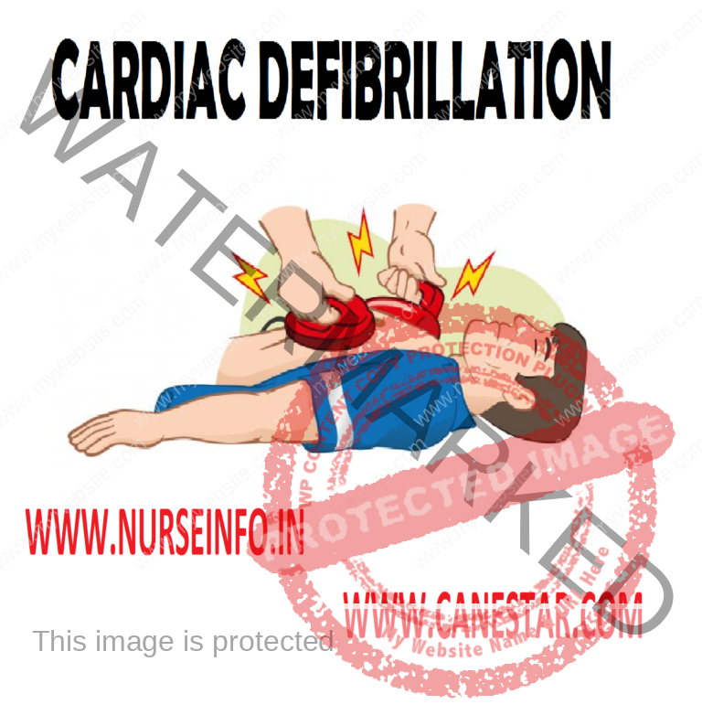CARDIAC DEFIBRILLATION Nurse Info
