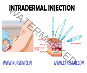 INTRADERMAL INJECTION - Nurse Info
