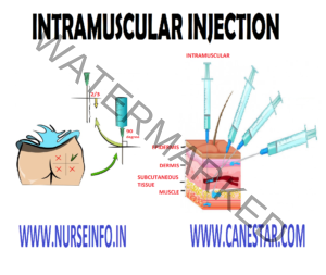 INTRAMUSCULAR INJECTION - Nurse Info
