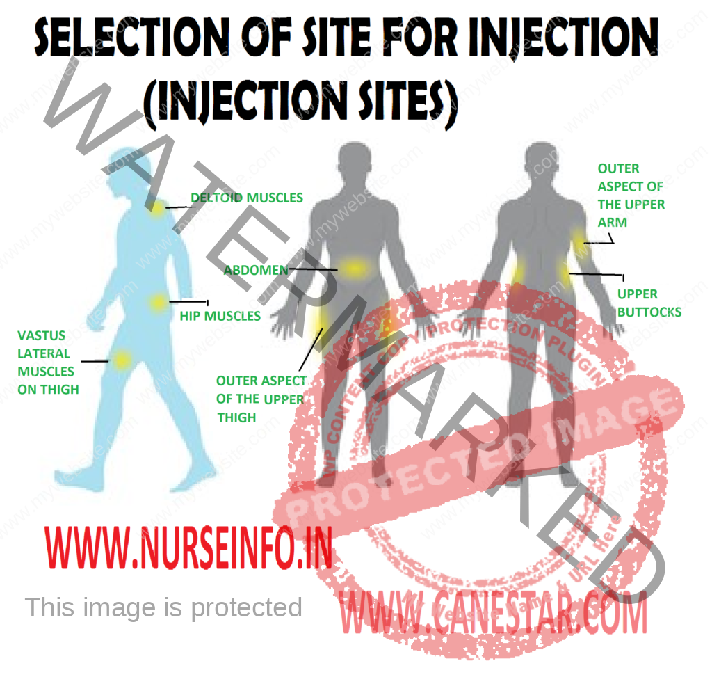 SELECTION OF SITE FOR INJECTION - Technical Skills, Criteria, Golden Rules