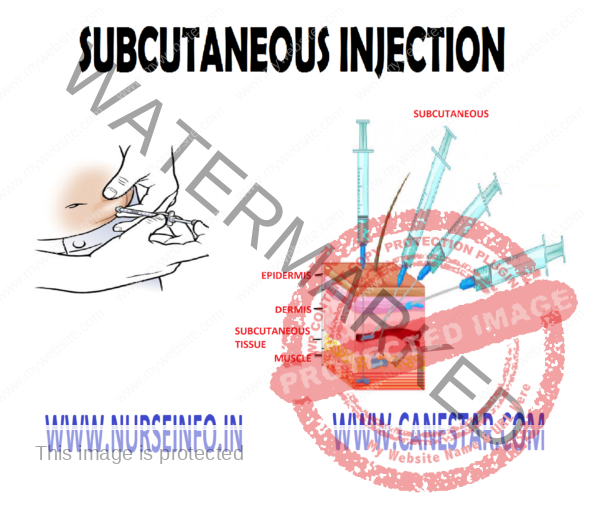 SUBCUTANEOUS INJECTION - Nurse Info