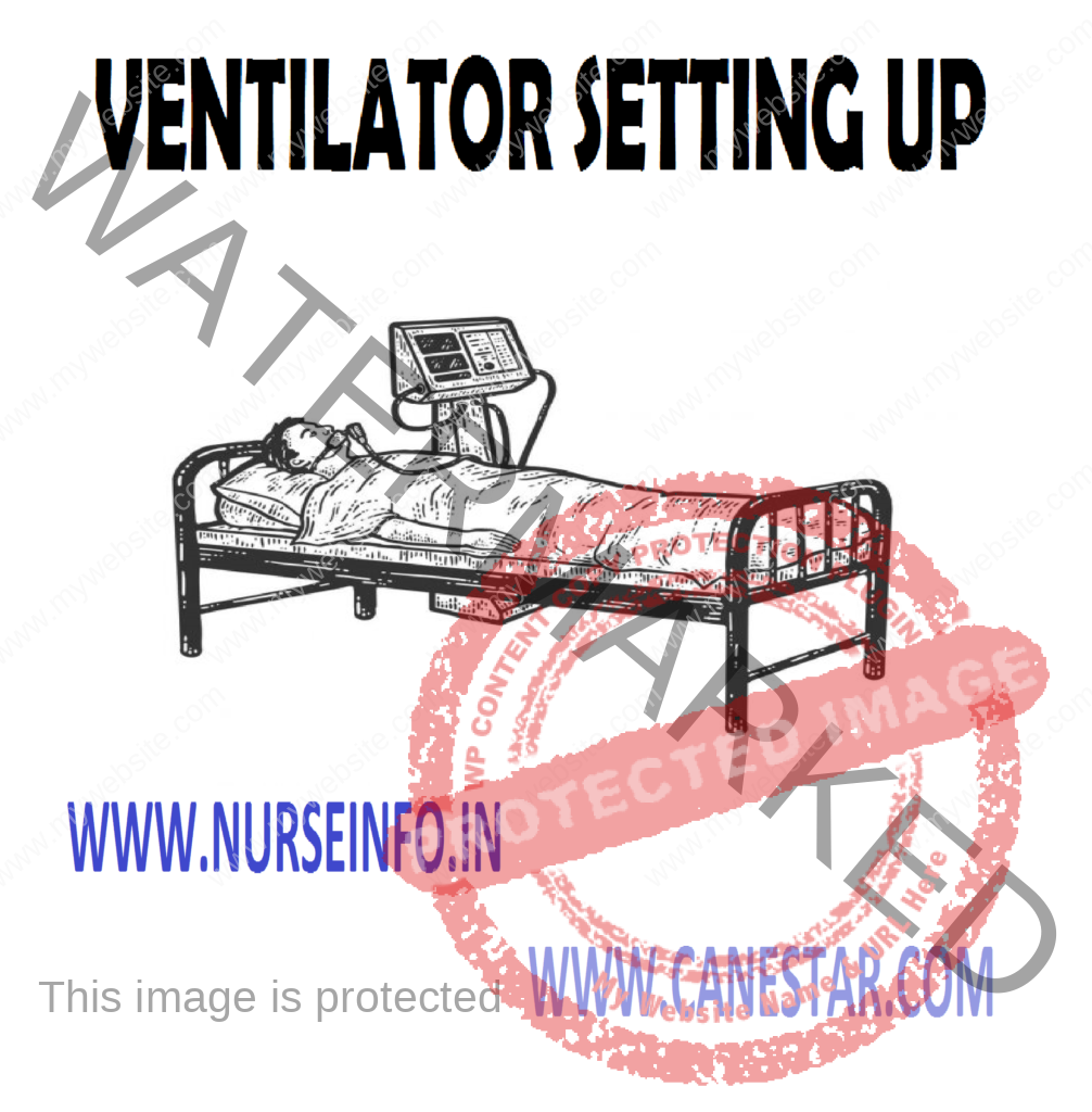 VENTILATOR SETTING UP – Ventilator Checks, Complications of Mechanical Ventilation, Fluid Retention and Hemodynamic Alteration and Ventilator Trouble Shooting 