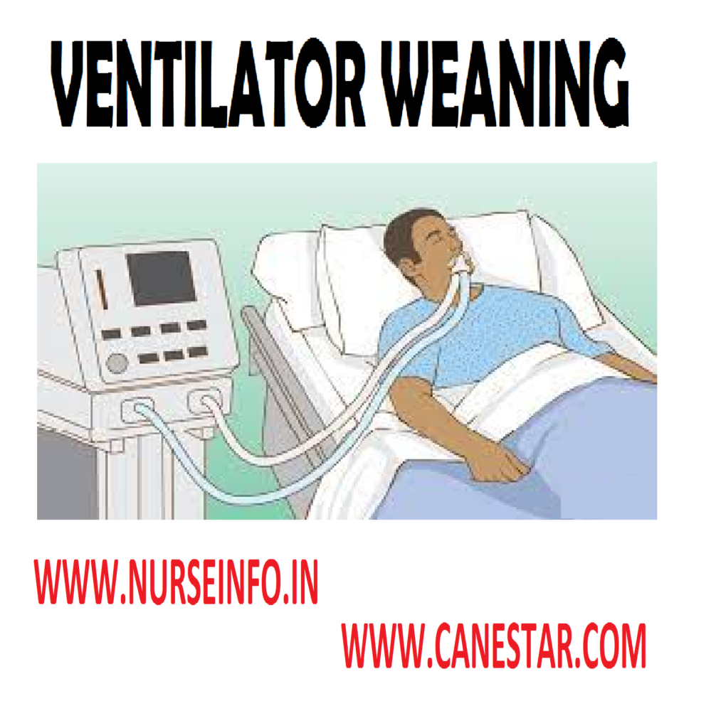 VENTILATOR WEANING – Respiratory Parameters (Huba), Signs of Fatigue, Methods of Fatigue, Methods of Weaning, Causes of Failure to Wean and Patient Who is Fighting the Ventilator 