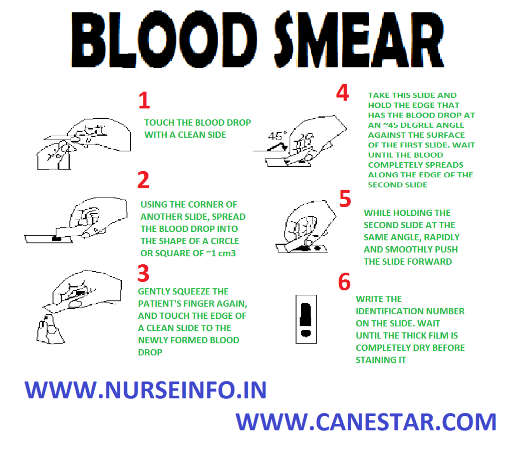 BLOOD SMEAR  -  Purpose,  Instructions,  Preliminary Assessment,  Preparation of the Patient and Environment,  Equipment,  Procedure,  After Care,  Blood Smear Collection Procedure  