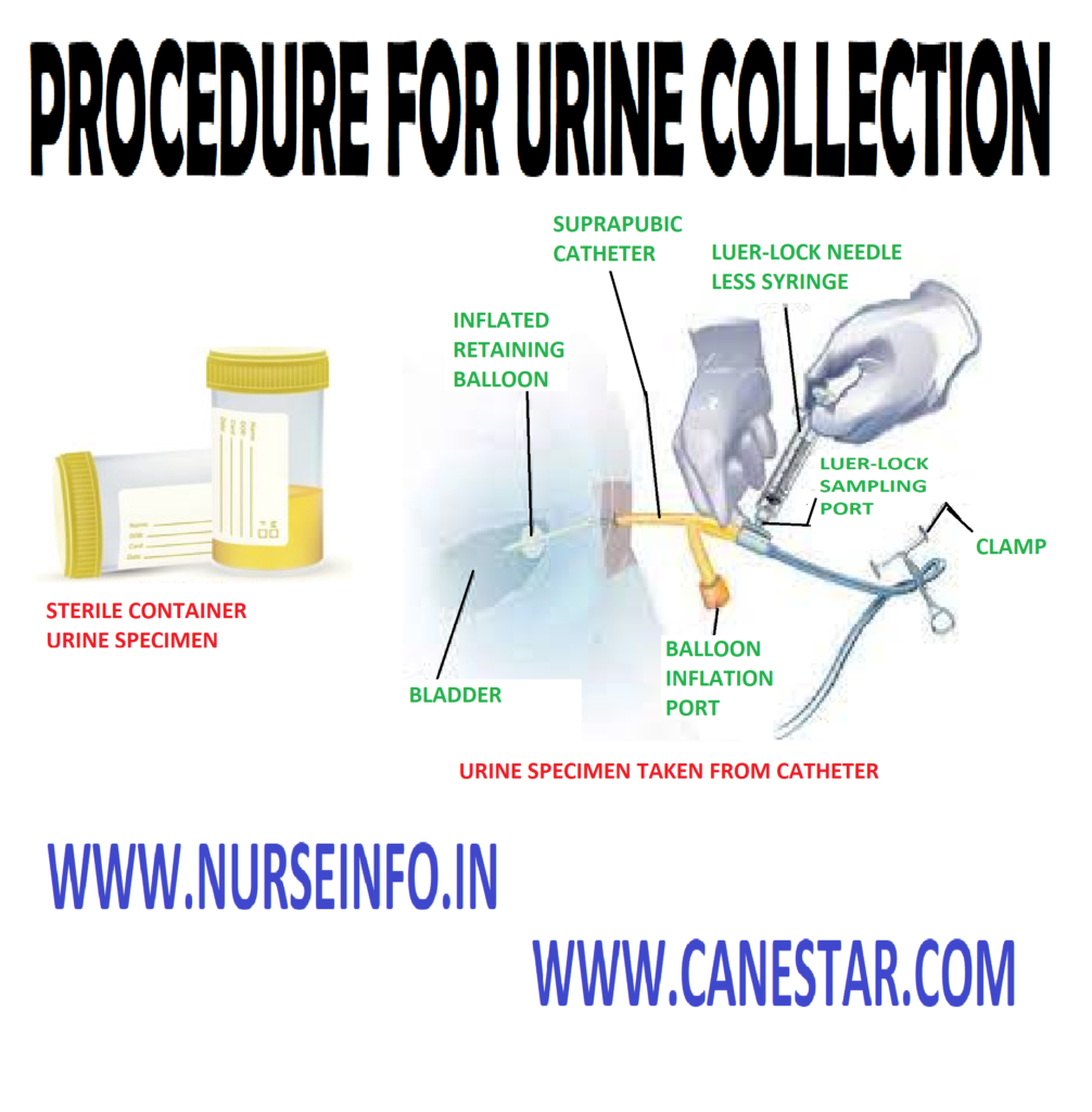 PROCEDURE FOR URINE COLLECTION - Purpose, Normal Characteristics of Urine, Urine Collects from Catheter ,Preliminary Assessment, Preparation of the Patient and Environment, Equipment, Procedure, After Care, Instructions