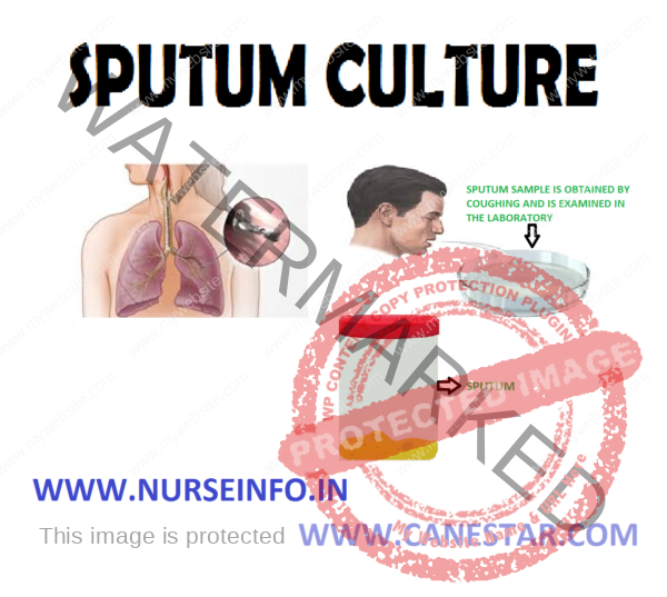 SPUTUM CULTURE | Nurse Info Sputum Specimen Collection Guidelines And ...