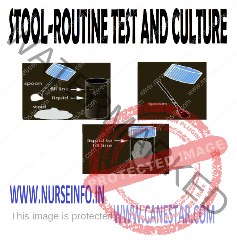 STOOL SPECIMENCOLLECTION General Guidelines