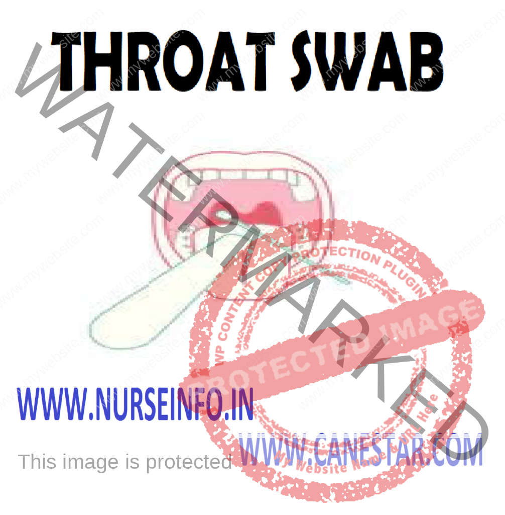 THROAT SWAB -  Purpose,  Indications,  Instructions,  Preliminary Assessment,  Preparation of the Patient and Environment,  Equipment,  Procedure,  After Care  