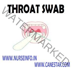 THROAT SWAB PROCEDURE AND COLLECTION