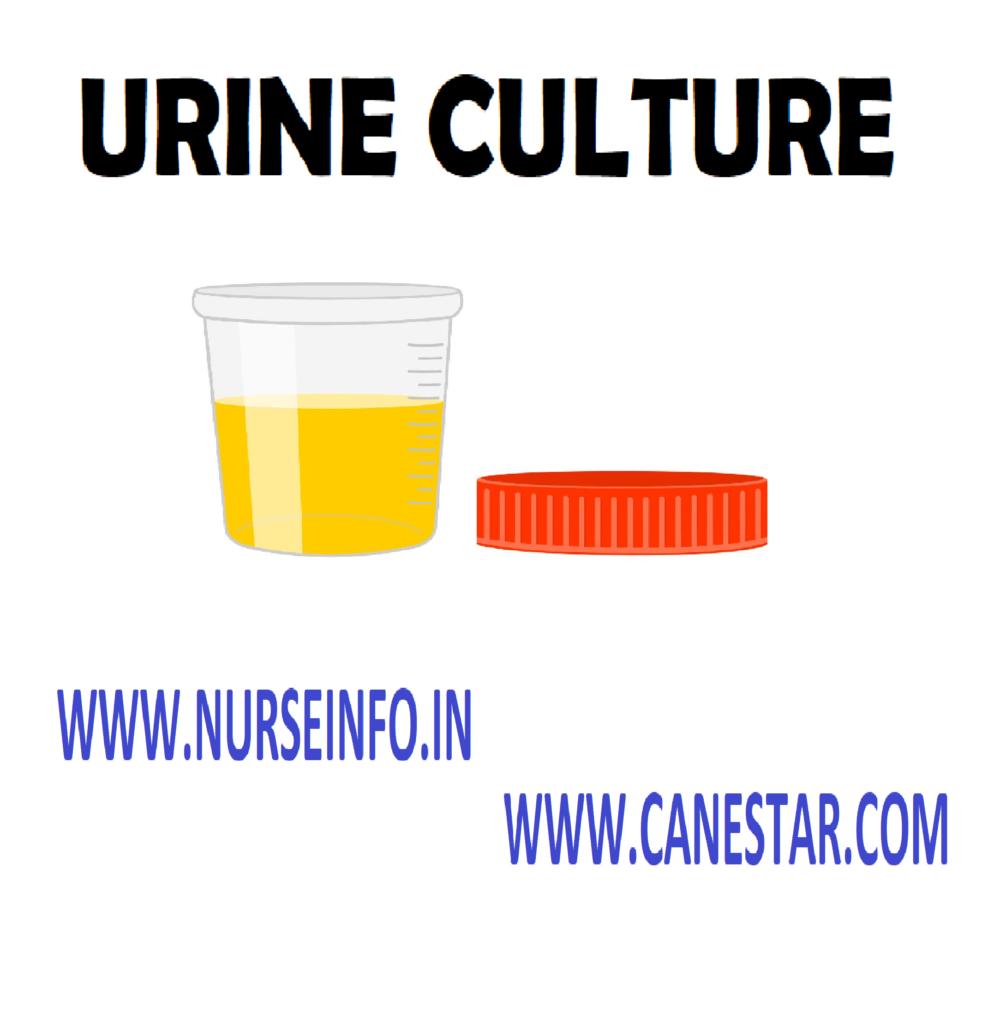  URINE CULTURE  -  Purpose,  Instructions,  Preliminary Assessment,  Preparation of the Patient and Environment,  Equipment,  Procedure,  After Care  