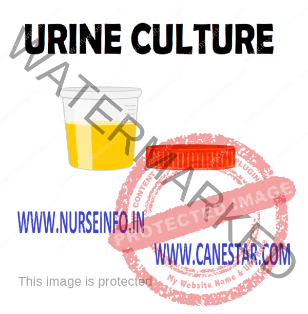 How Long Does It Take to Get Urine Culture Results? A Comprehensive Guide