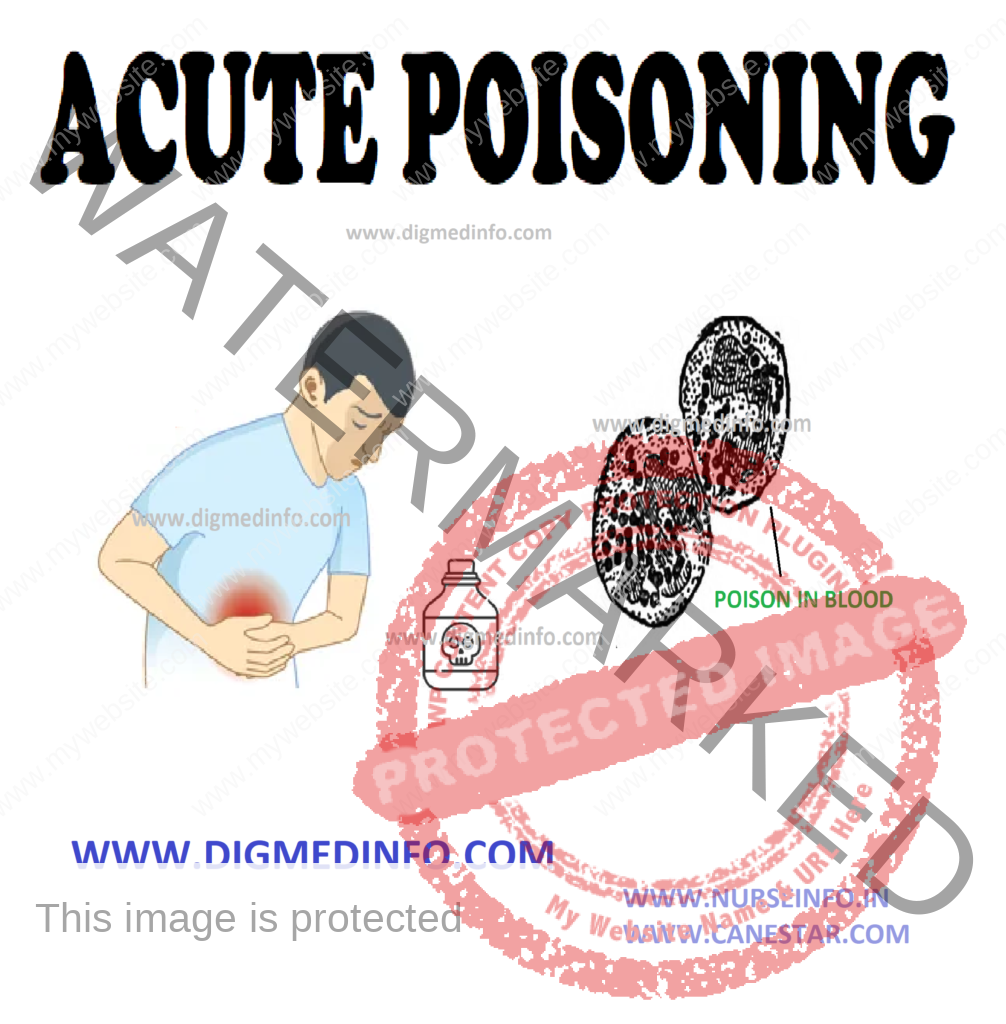 ACUTE POISONING – General Considerations, Clinical Presentation, General Management, Specific Measures, Forced Diuresis and Dialysis and Hemoperfusion 