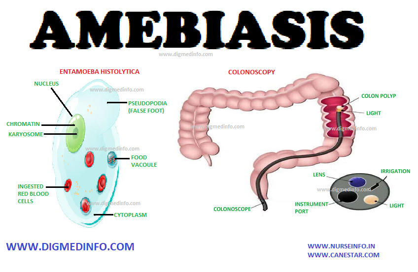 AMEBIASIS – General Characteristics, Pathology, Clinical Manifestations, Acute Amebic Dysentery, Hepatic Amebiasis and Treatment of Amebiasis