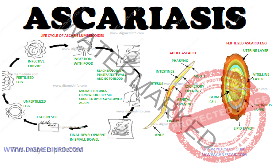 ASCARIASIS – General Characteristics, Life Cycle, Pathogenesis, Clinical Features, Diagnosis, Treatment and Prevention 