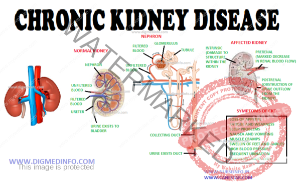 CHRONIC KIDNEY DISEASE – DEFINITION AND STAGING, ETIOLOGY, NATURAL ...