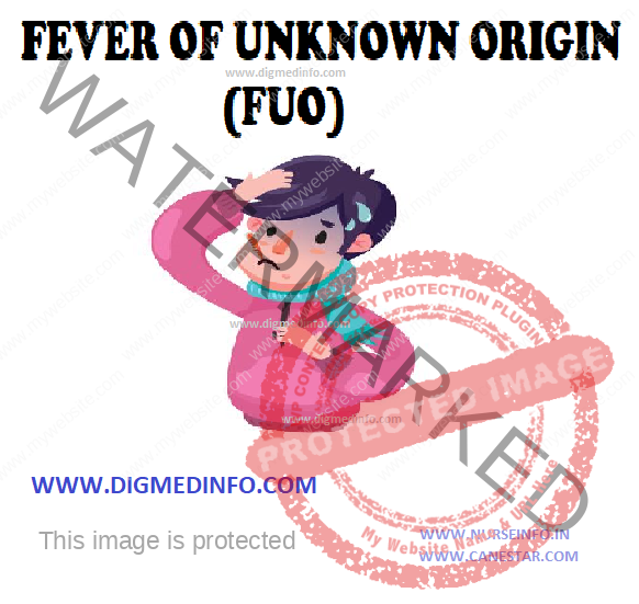 FEVER OF UNKNOWN ORIGIN (FUO) – Definition, Etiology, Diagnosis and Investigations 