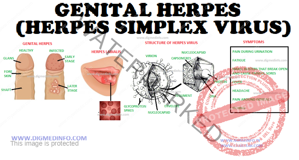 GENITAL HERPES (HERPES SIMPLEX VIRUS) – General Characteristics, Cytology, Treatment and Prophylaxis 