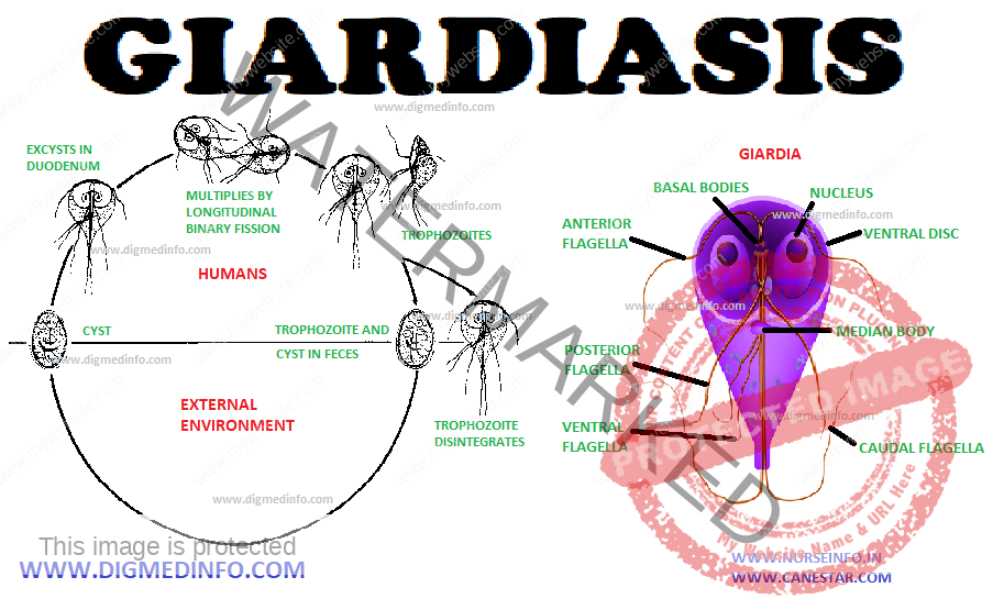 GIARDIASIS - General Characteristics, Transmission, Pathogenesis, Clinical Features, Diagnosis and Treatment 