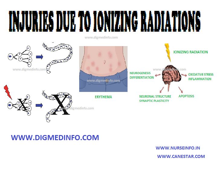 INJURIES DUE TO IONIZING RADIATIONS – General Considerations, Acute Radiation Syndrome, Damage to Embryo by Irradiation in Fetal Life and Local Radiation Injury 