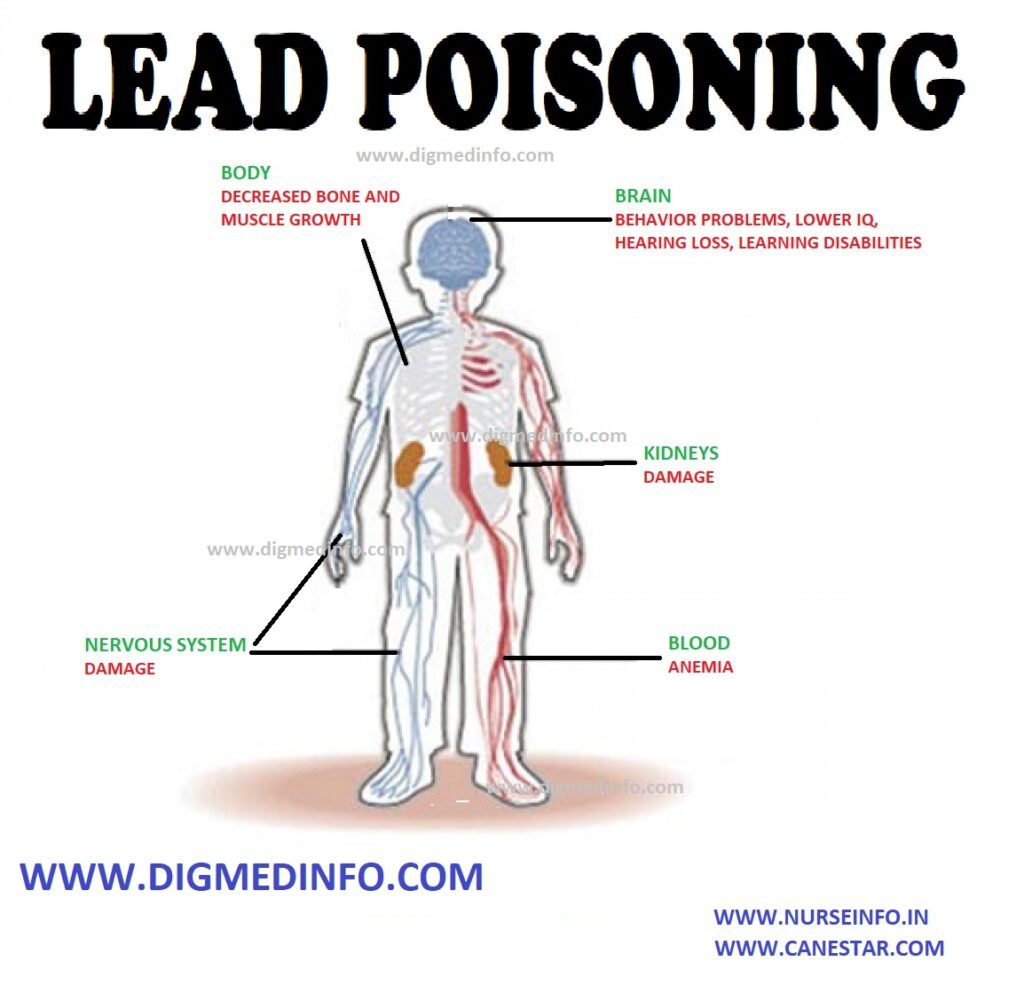 LEAD POISONING – General Features, Treatment, Chronic Lead Poisoning – Diagnosis, Treatment and Prevention 