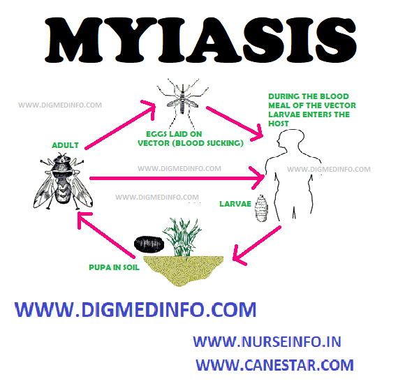 MYIASIS – General Characteristics, Classification, Cutaneous Myiasis (localized), Deep Myiasis, Ophthalmic Myiasis, Intestinal and Urinary Myiasis