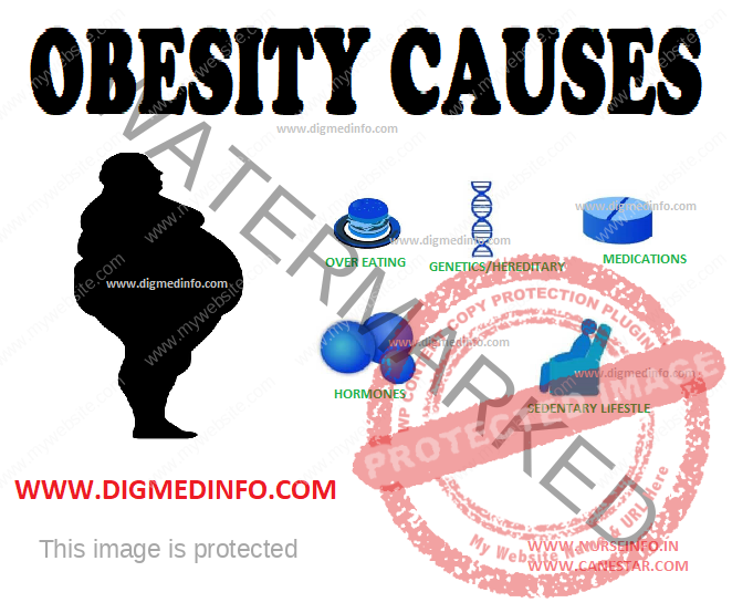 OBESITY – CAUSES AND PATHOLOGY 