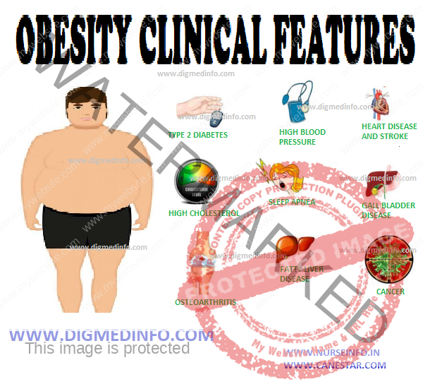 OBESITY – CLINICAL FEATURES, COURSE AND PROGNOSIS and DIAGNOSIS 