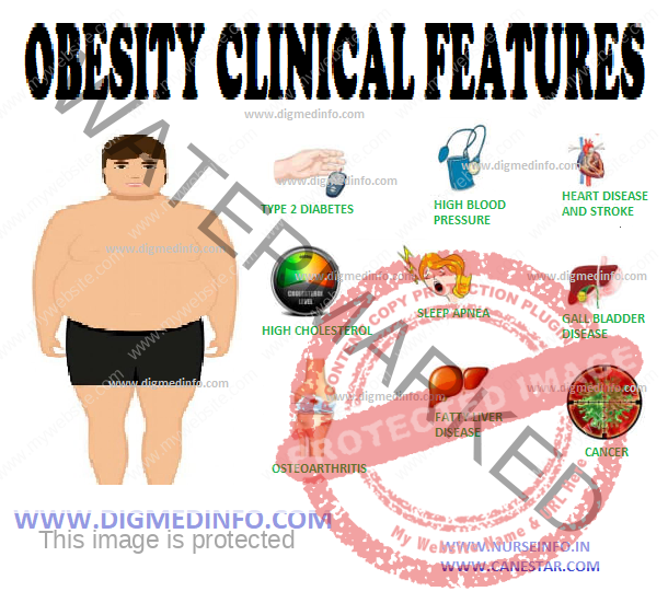 describe research findings on obesity and weight control