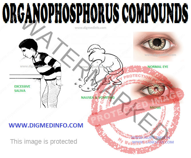 ORGANOPHOSPHORUS COMPOUNDS – General Features, Clinical Features, Diagnosis and Treatment 