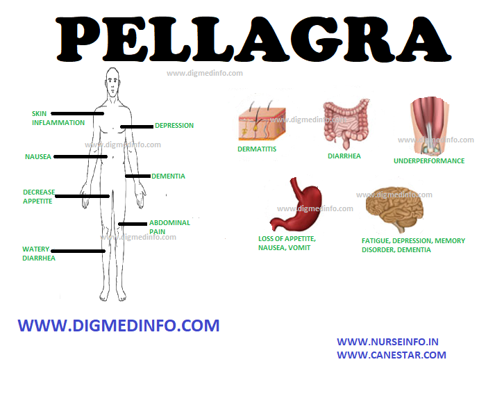PELLAGRA – General Features, Pathology, Clinical Features, Skin Changes, Course and Prognosis, Treatment and Prevention 
