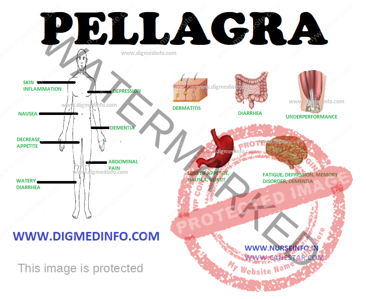 PELLAGRA – General Features, Pathology, Clinical Features, Skin Changes, Course and Prognosis, Treatment and Prevention 