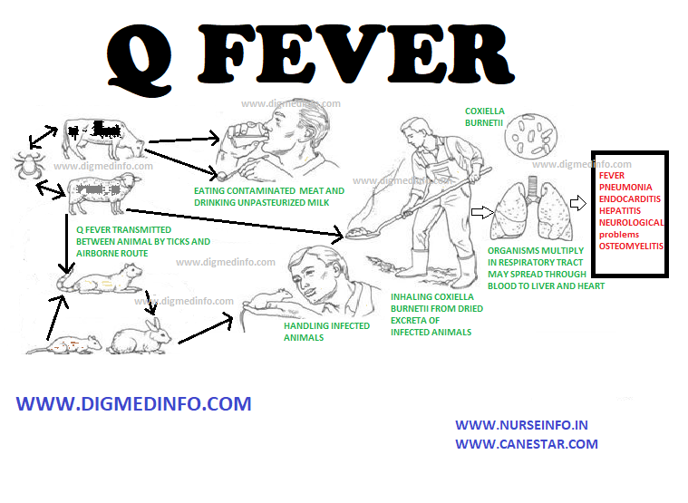 Q FEVER – Forms, Acute Q fever, Chronic Q Fever, Diagnosis, Treatment and Prevention 