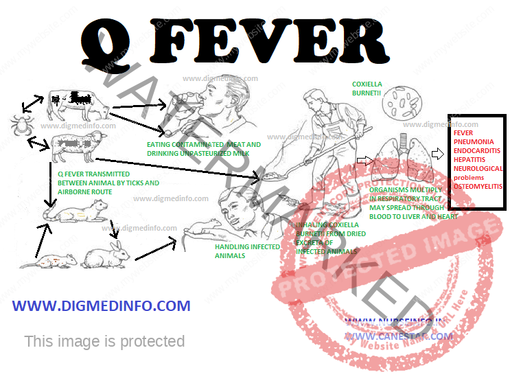 Q FEVER – Forms, Acute Q fever, Chronic Q Fever, Diagnosis, Treatment and Prevention 